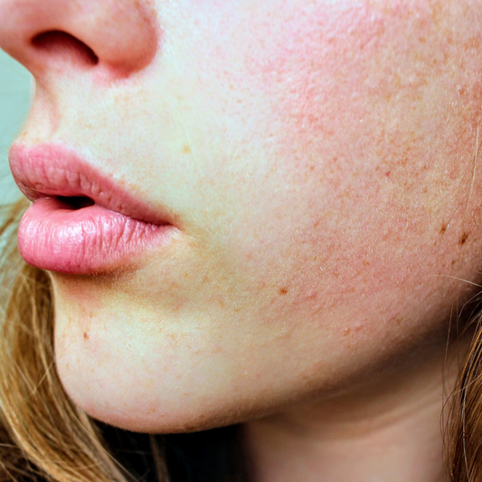 Alcohol Allergy vs Alcohol Intolerance: Which Do You Actually Have?