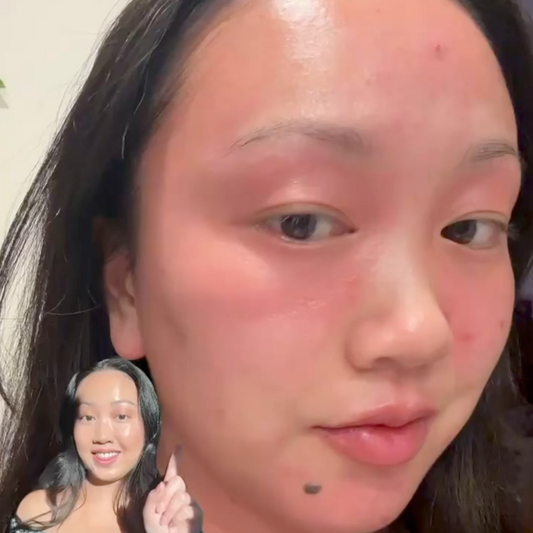 How Long Does Asian Flush Last? Causes, Timeline, and What Helps