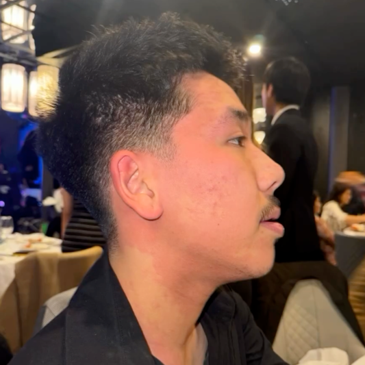Why Do My Ears Turn Red After Drinking Alcohol?