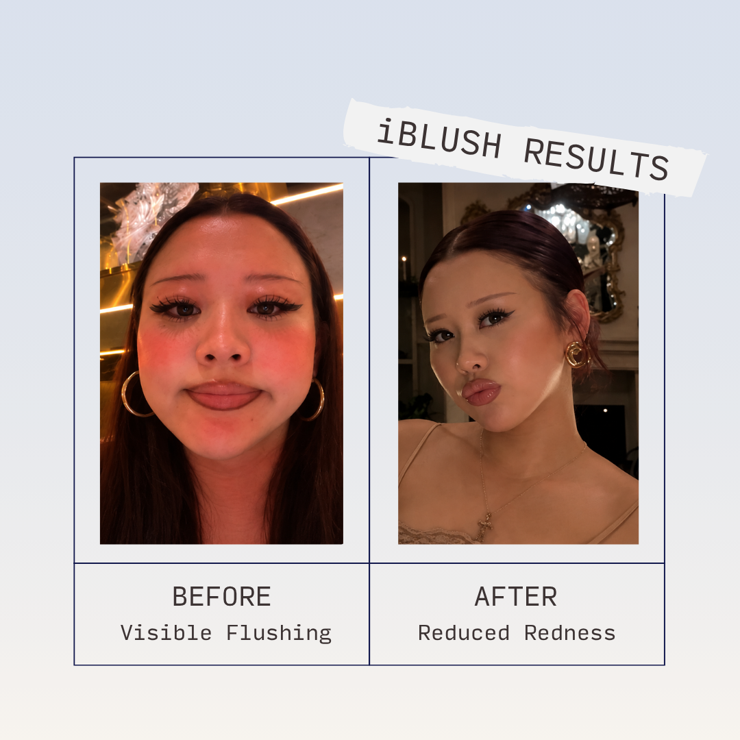 Side-by-side customer photos of a woman showing visible facial redness before and reduced redness after, labelled as iBlush results.