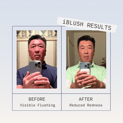 Customer-submitted before-and-after photos of a man showing visible facial flushing in the first image and less redness in the second.